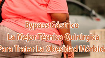 Bypass Gástrico - La Mejor Técnica Quirúrgica Para Tratar La Obesidad Mórbida