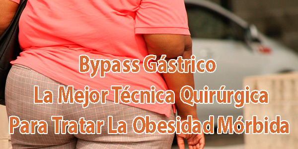 Bypass Gástrico - La Mejor Técnica Quirúrgica Para Tratar La Obesidad Mórbida