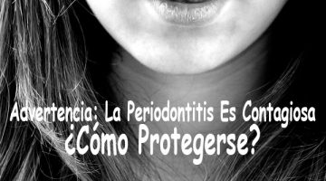 Advertencia: La Periodontitis Es Contagiosa - ¿Cómo Protegerse?