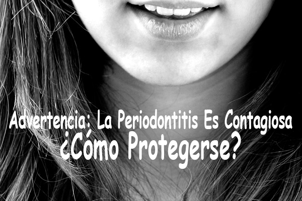 Advertencia: La Periodontitis Es Contagiosa - ¿Cómo Protegerse?