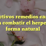 5 efectivos remedios caseros para combatir el herpes de forma natural